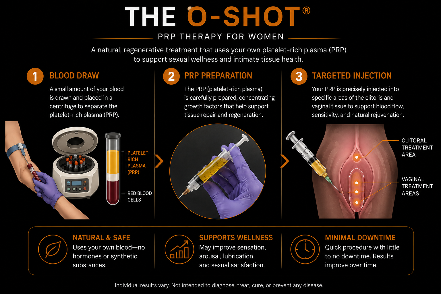 Infographic showing the three steps of the O-Shot procedure: blood draw and PRP preparation, treatment area preparation with topical anesthetic, and targeted PRP injection into the vaginal and clitoral treatment areas