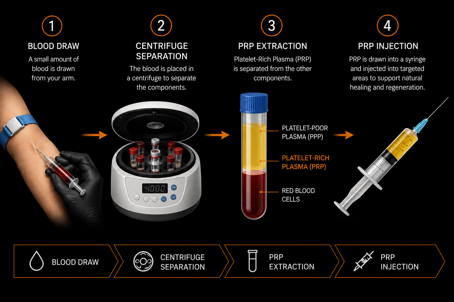 Infographic showing the four steps of P-Shot PRP preparation: blood draw, centrifuge separation, PRP extraction, and PRP injection