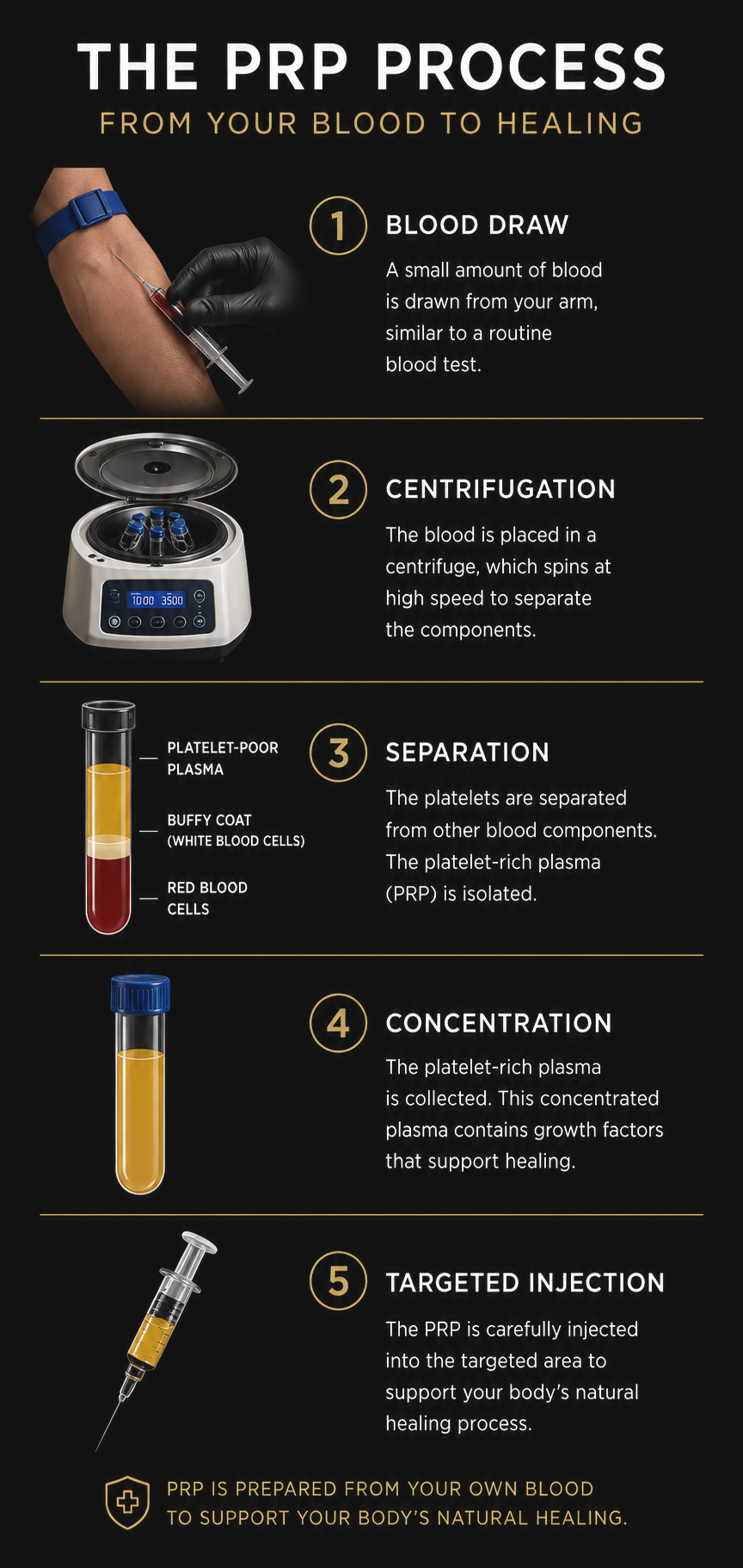Infographic showing the PRP process: blood draw, centrifugation, separation of platelet-rich plasma from platelet-poor plasma and red blood cells, concentration, and targeted injection